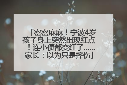 密密麻麻！宁波4岁孩子身上突然出现红点！连小便都变红了……家长：以为只是摔伤